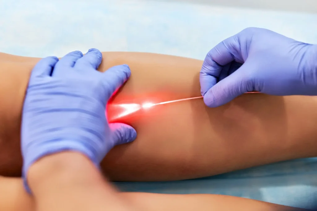 Dra. Soraia Helal - Angiologista e Cirurgiã Vascular em Santo André